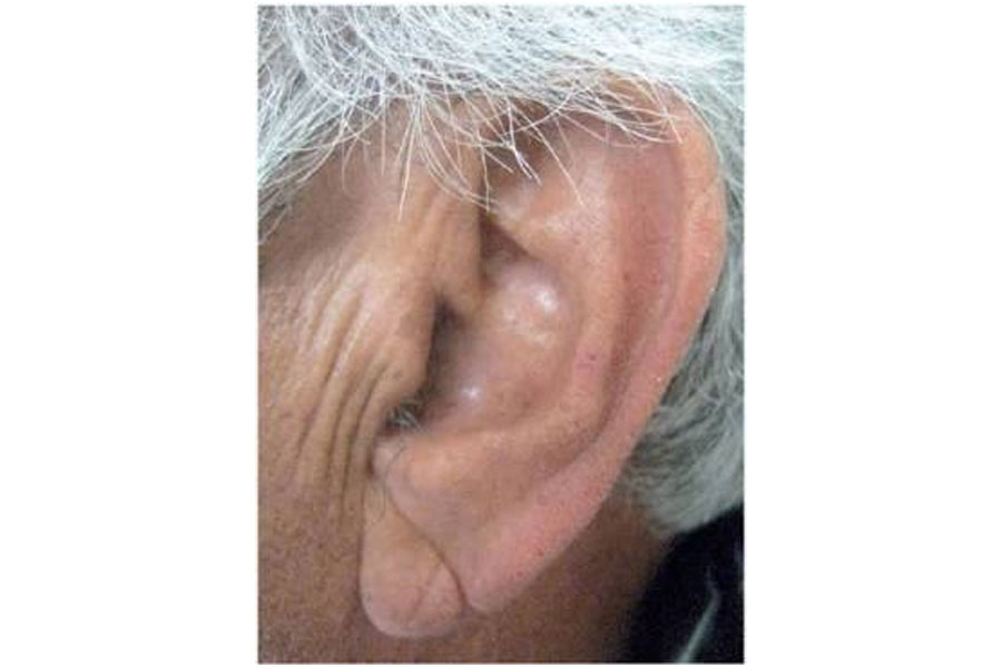 Ear fitness exercises